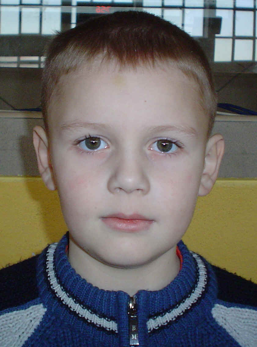 BRAK FOTO
