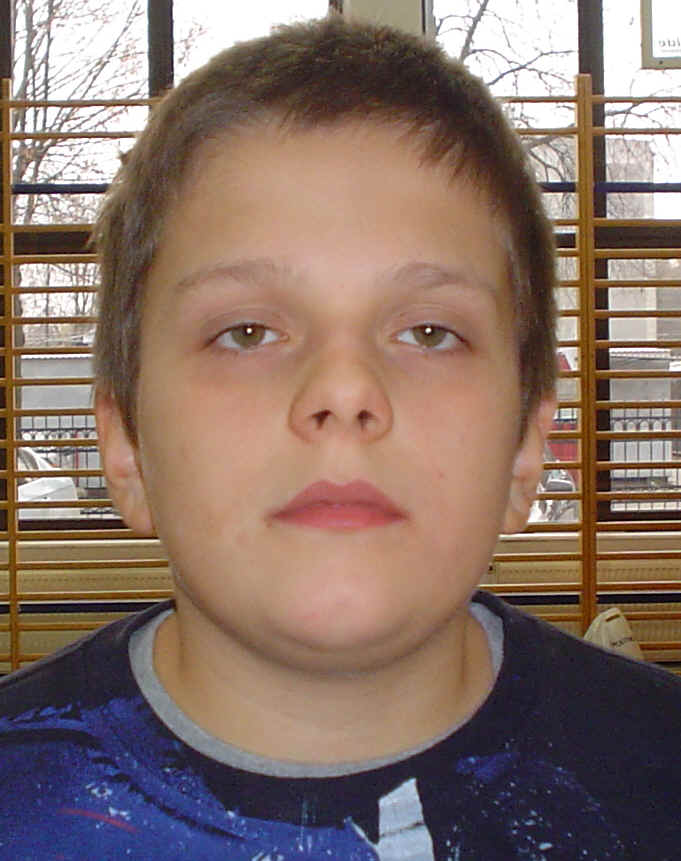 BRAK FOTO
